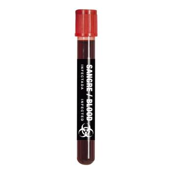 Kémcső - Vér 5 ml kép